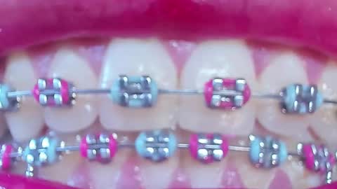 Snapshot of los_juanes chatting on February 28, 2026, 7:37 pm JUAN JUAN online show from February 28, 2026, 7:37 pm